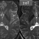 Illustration for article titled The Worlds Strongest MRI Will Be Able to Pick Up a Tank